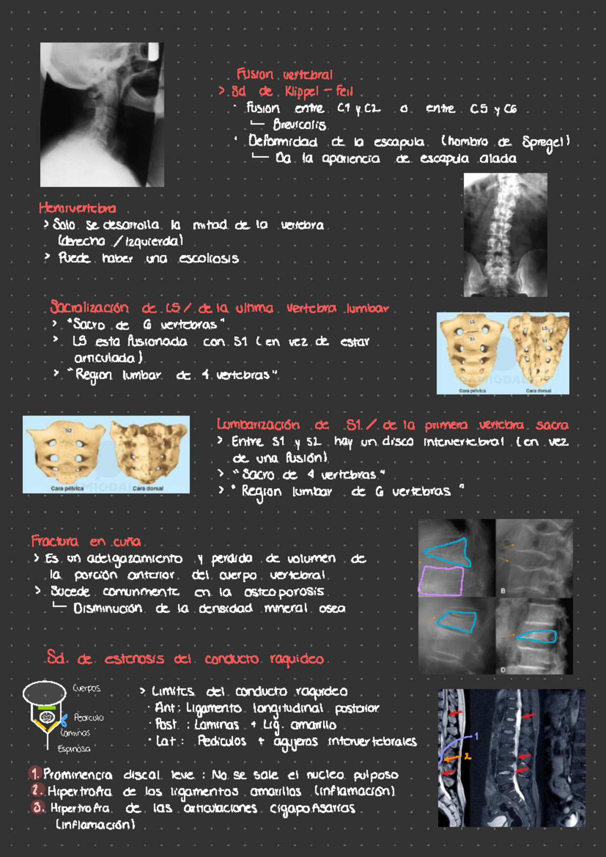 Final Exam Notes for Anatomy 2 (ANAT 2) - Vertebral Fusion and Related ...