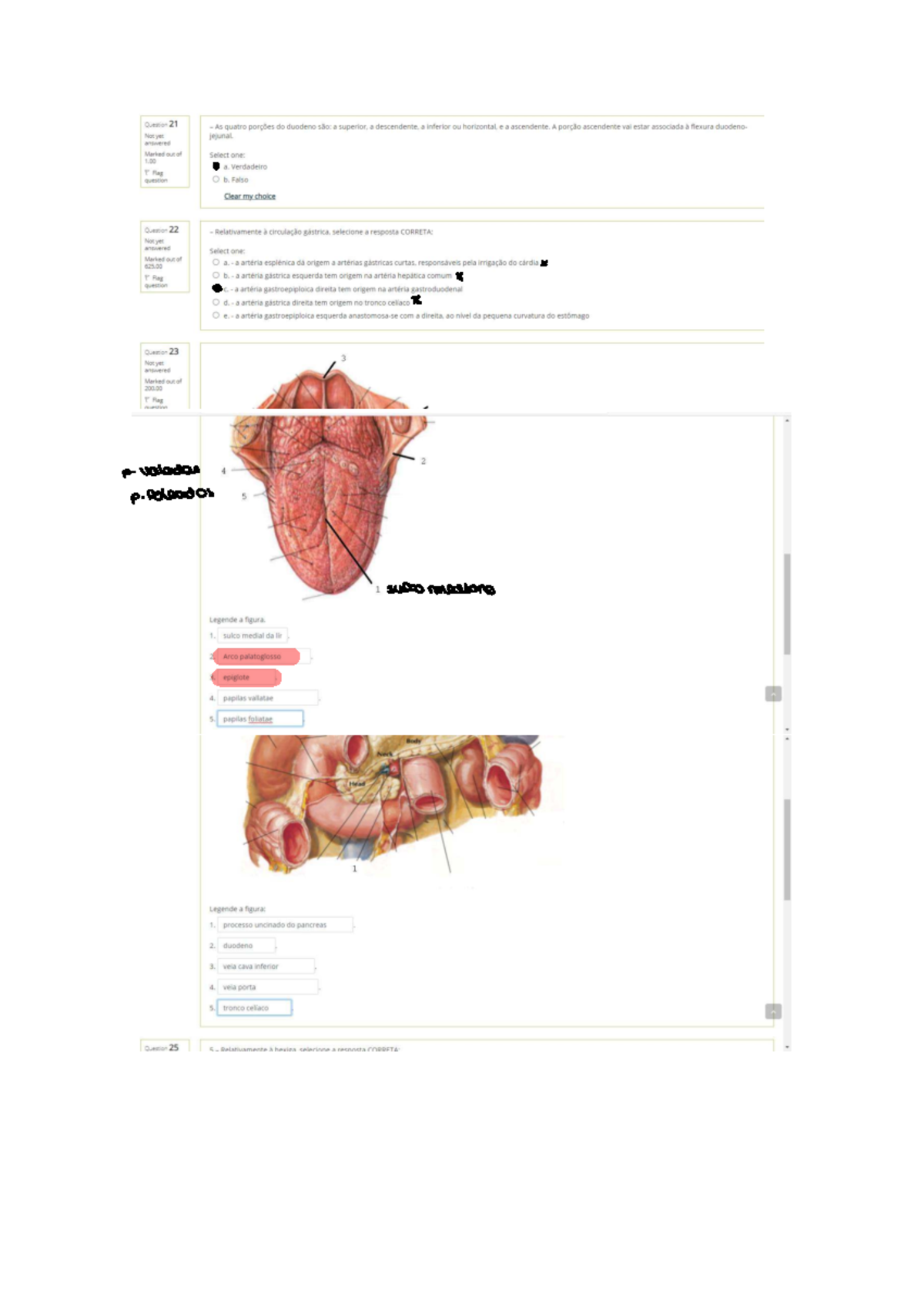 2º Teste de Anatomia - Questões e Respostas SOF3 - Studocu