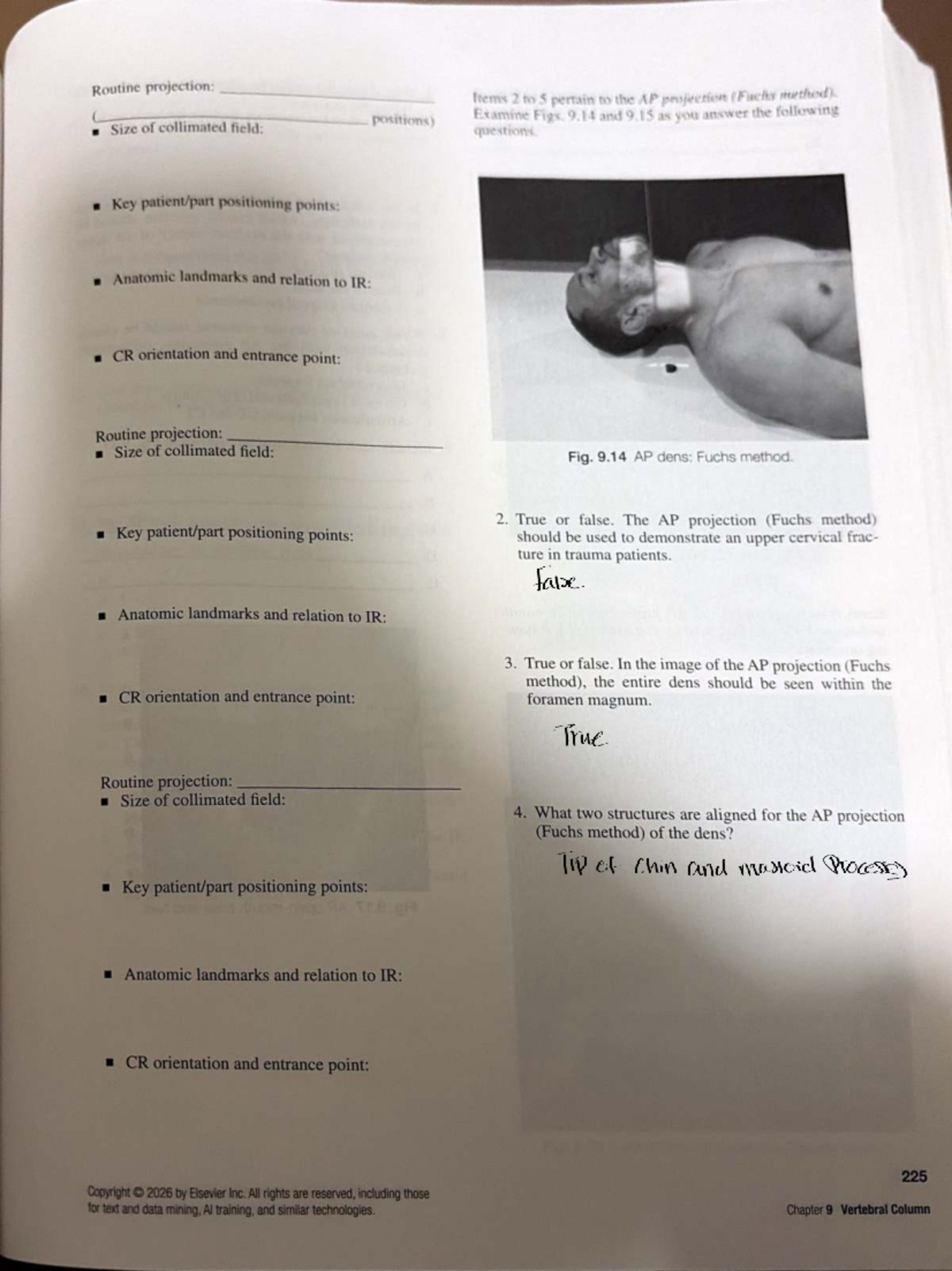 Chapter 9 Vertebral Column: AP Projection (Fuchs Method) Study Guide ...