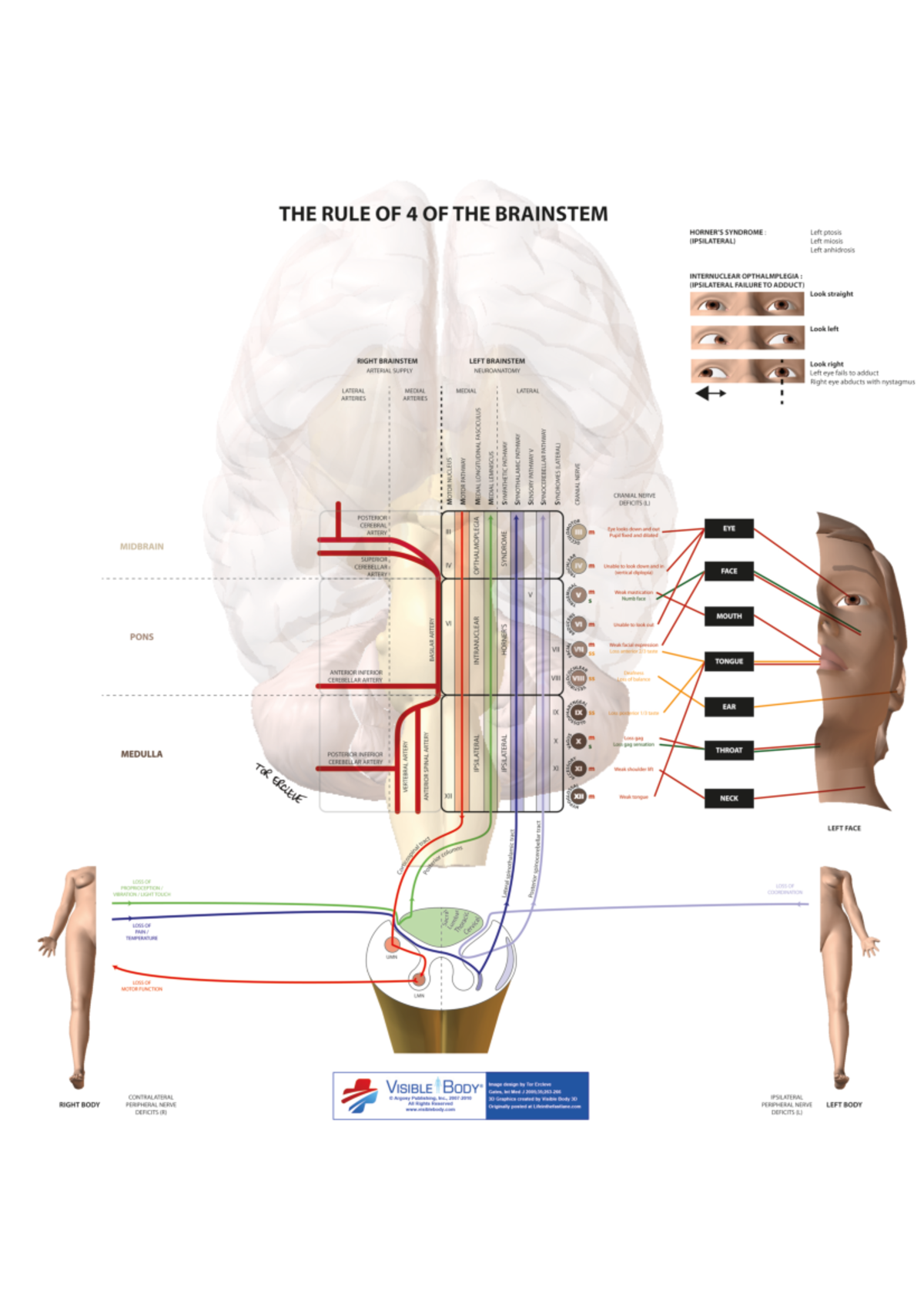 Brainstem Syndrome: The Rule of 4 Illustrated for Med Students - Studocu
