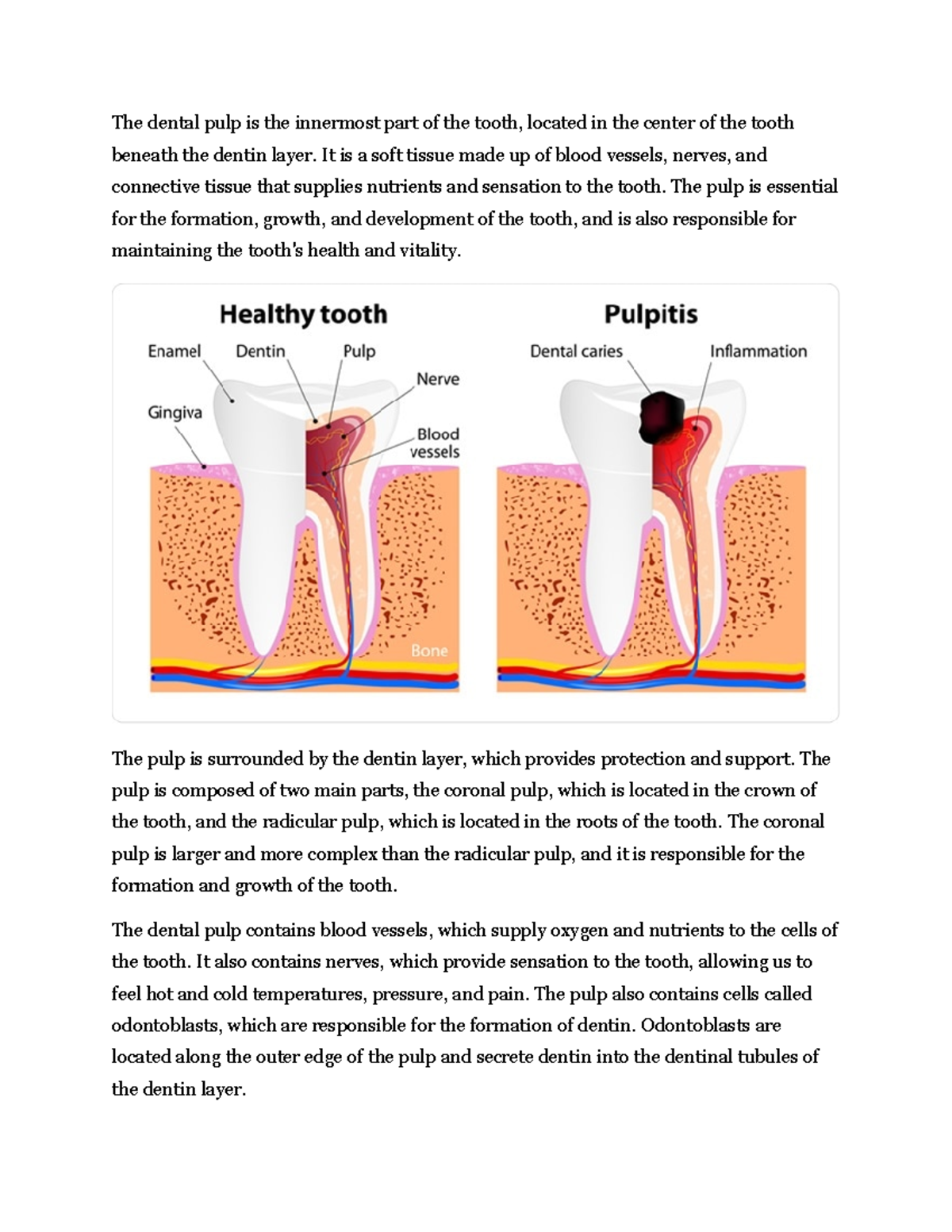 Parts of the teeth - The dental pulp is the innermost part of the tooth ...