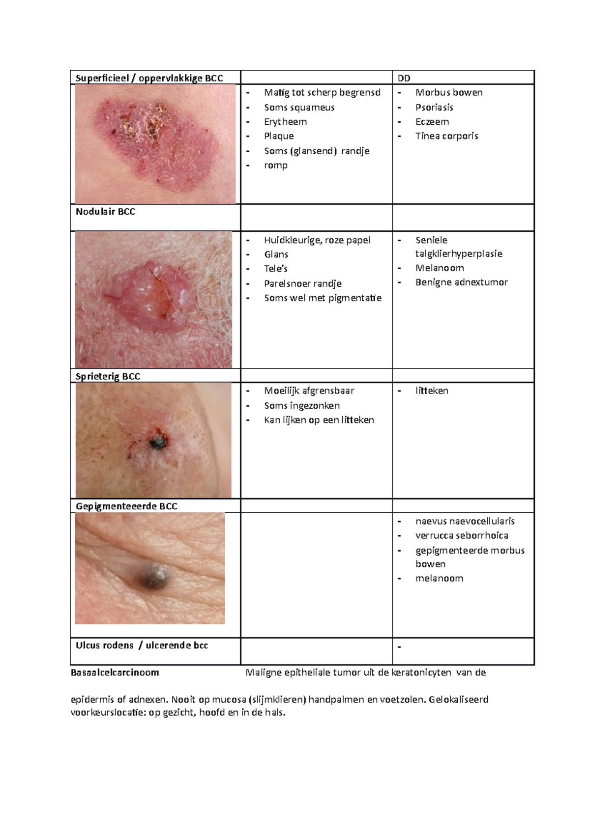 benigne tumor in functioneel gebied 1-3
