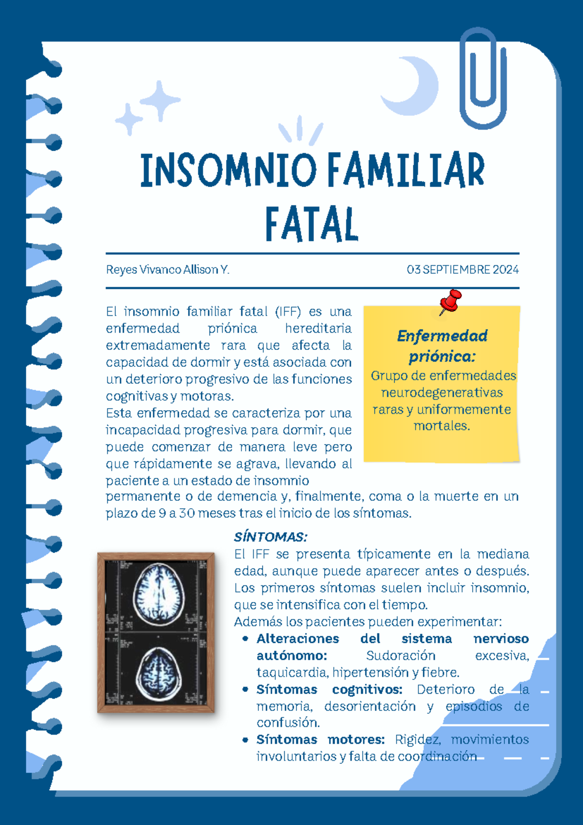 Insomnio Fatal Familiar - INSOMNIO FAMILIAR FATAL SÍNTOMAS: El IFF se ...