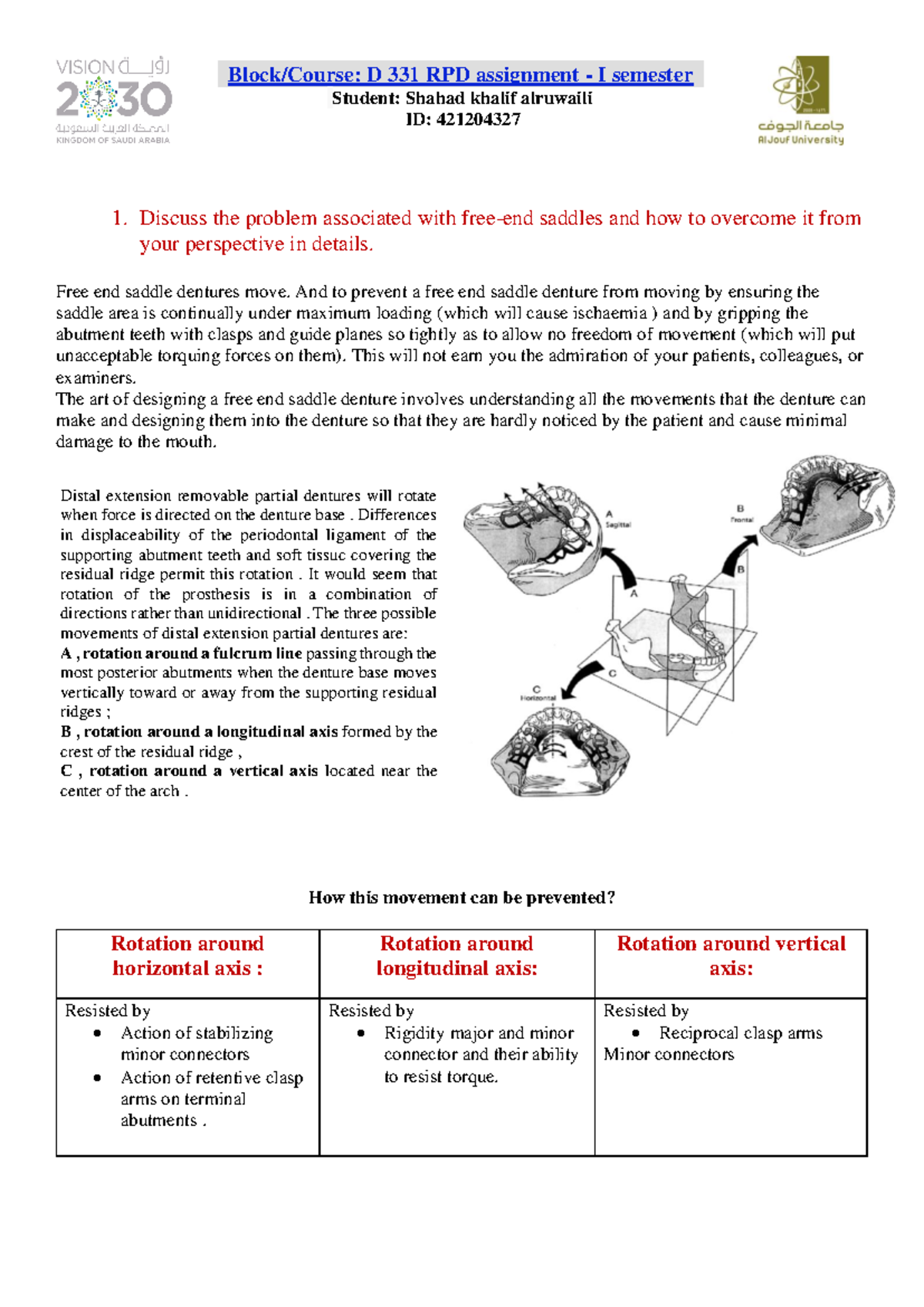 D 331 RPD 1: Free-End Saddles Problems and Solutions in Dentures - Studocu