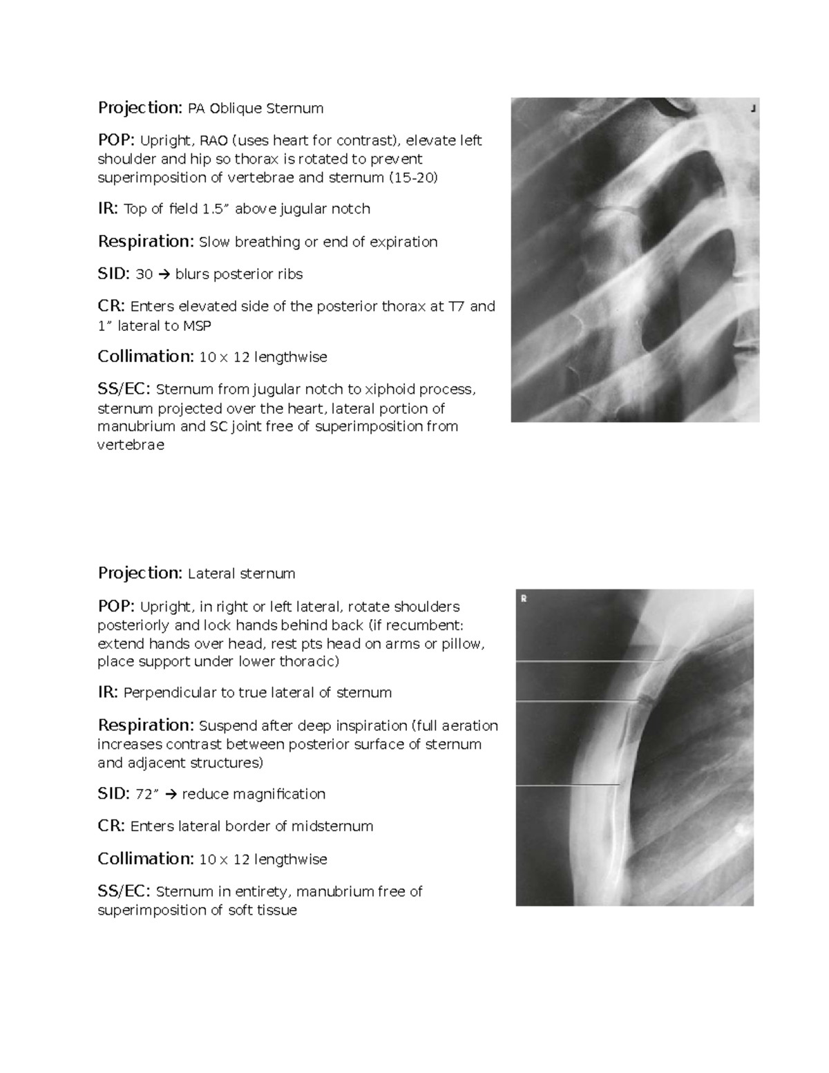 Bony Thorax Imaging Techniques: PA, Lateral, and Oblique Projections ...