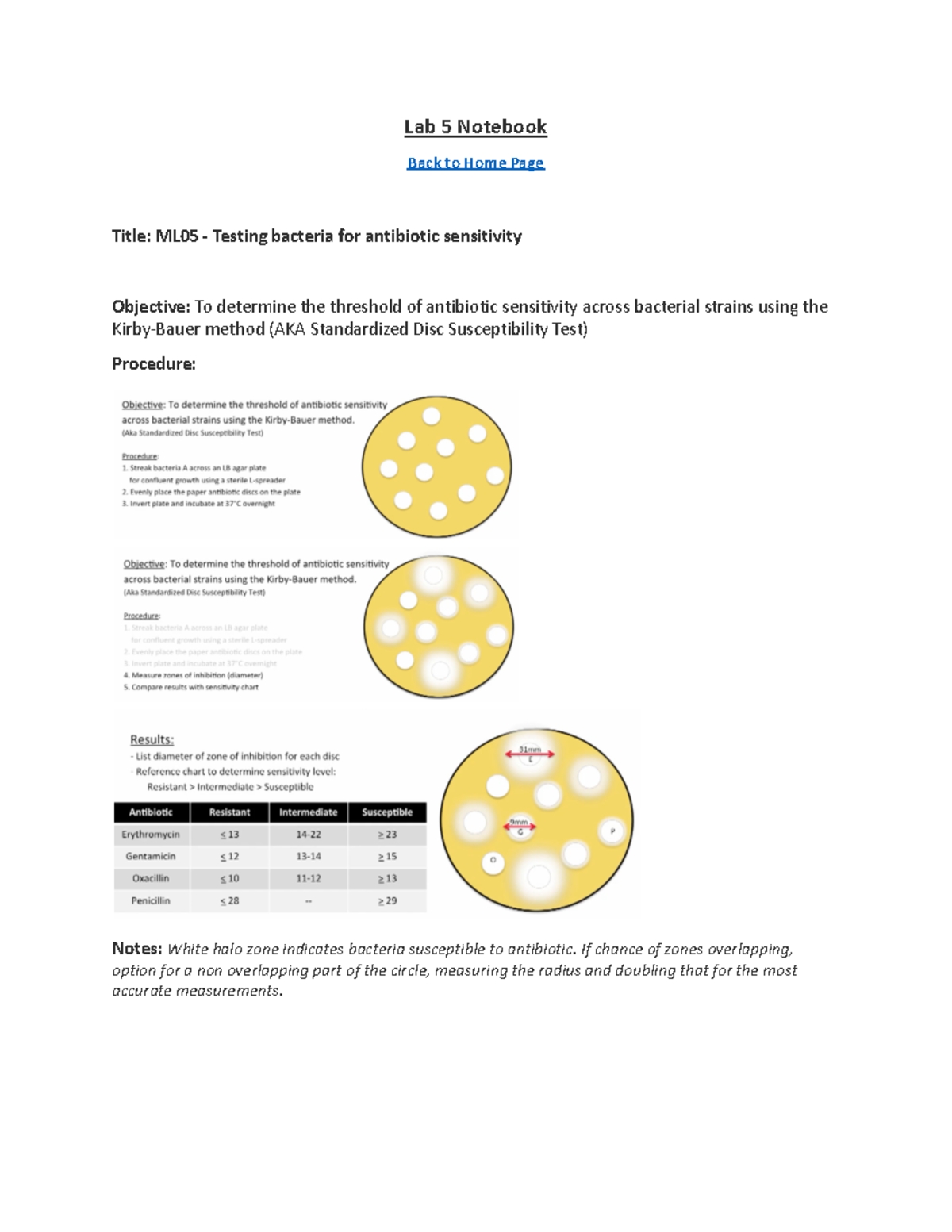 Lab 5 - ML 05 Antibiotic Sensitivity Testing Using Kirby-Bauer Method ...