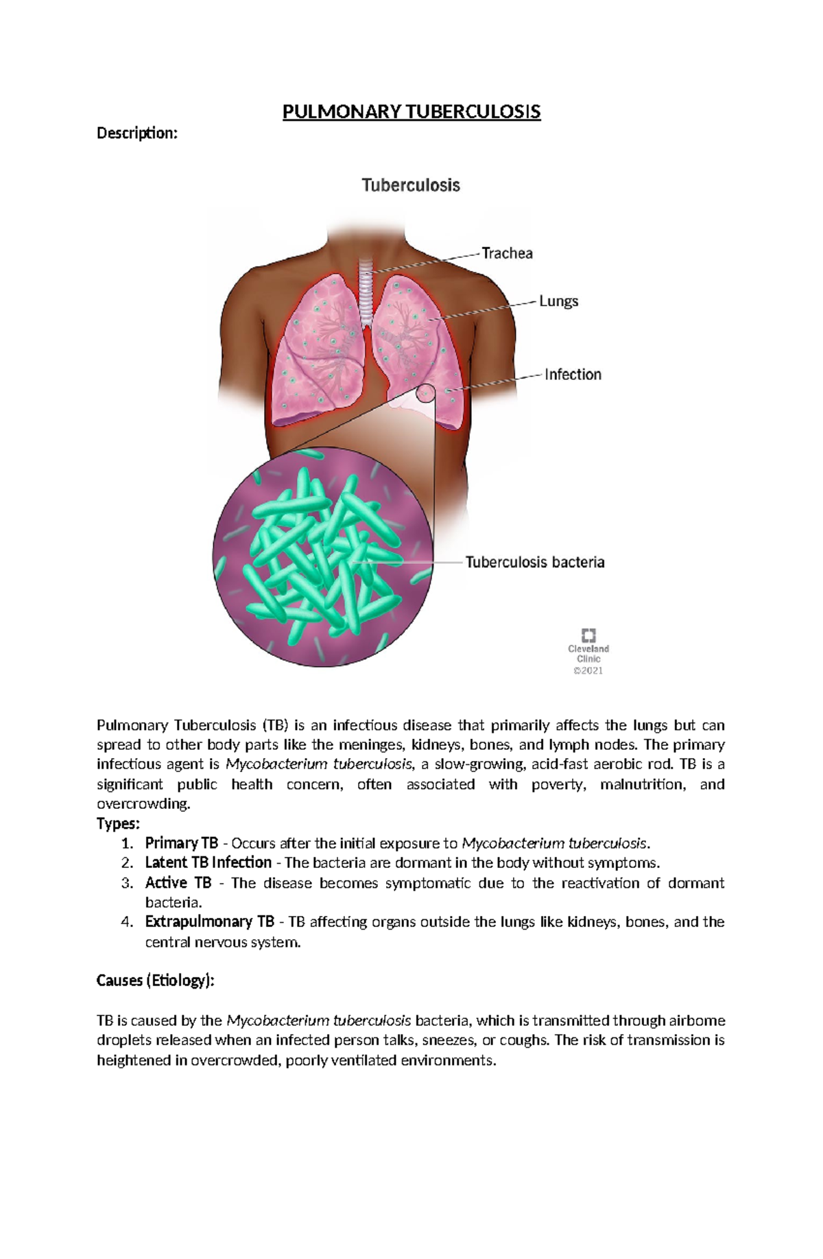 Pulmonary Tuberculosis - PULMONARY TUBERCULOSIS Description: Pulmonary ...