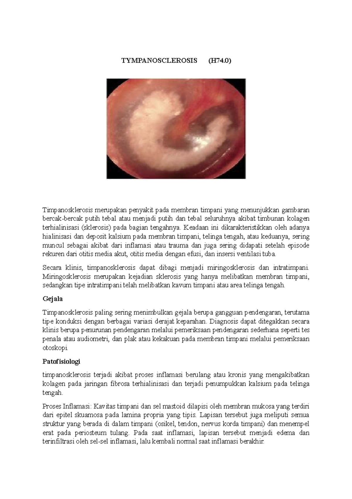 Tympanosklerosis: Understanding Pathophysiology, Symptoms, and ...