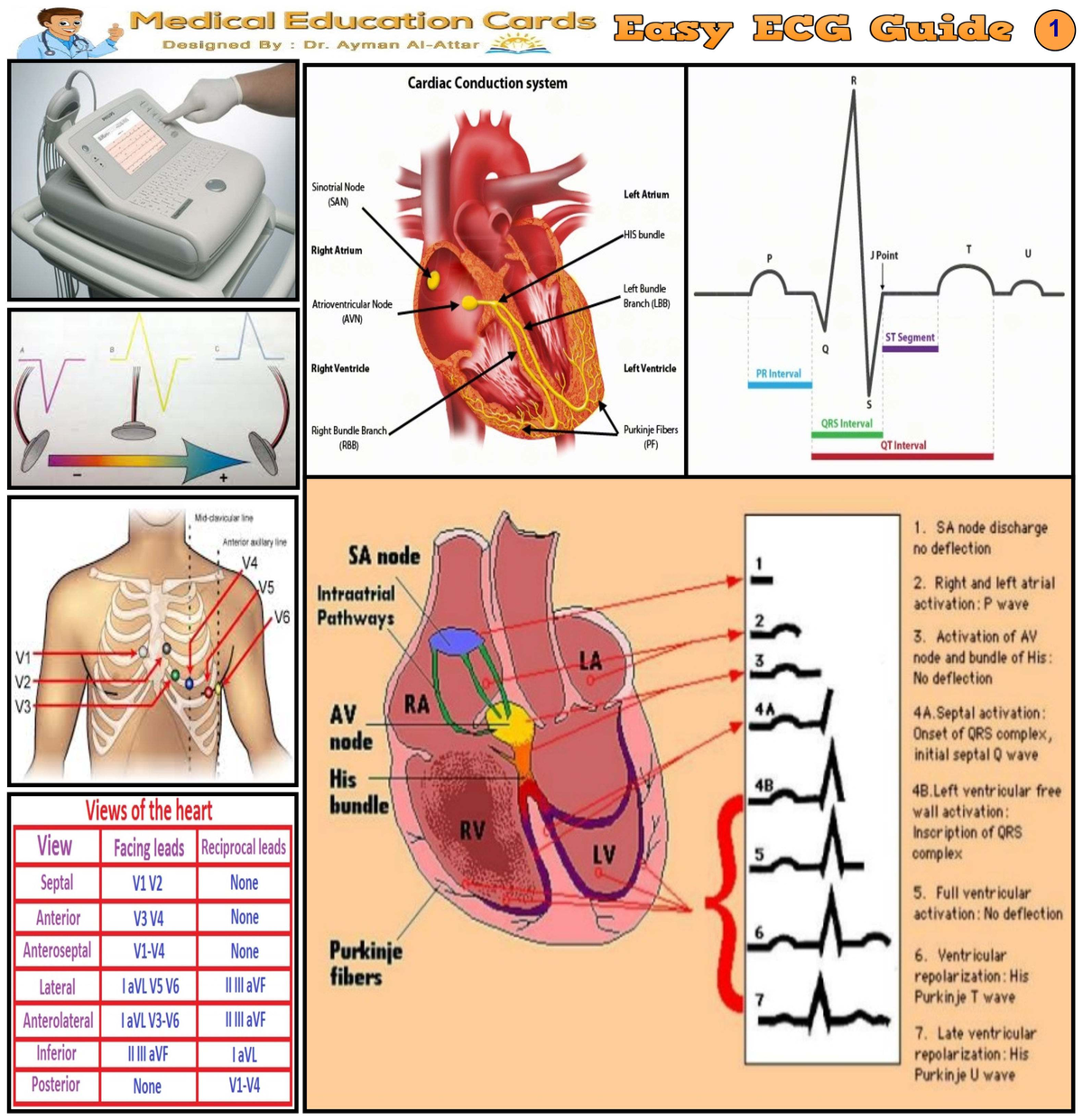 Easy ECG Guide - Comprehensive Overview of Cardiac Conduction System ...