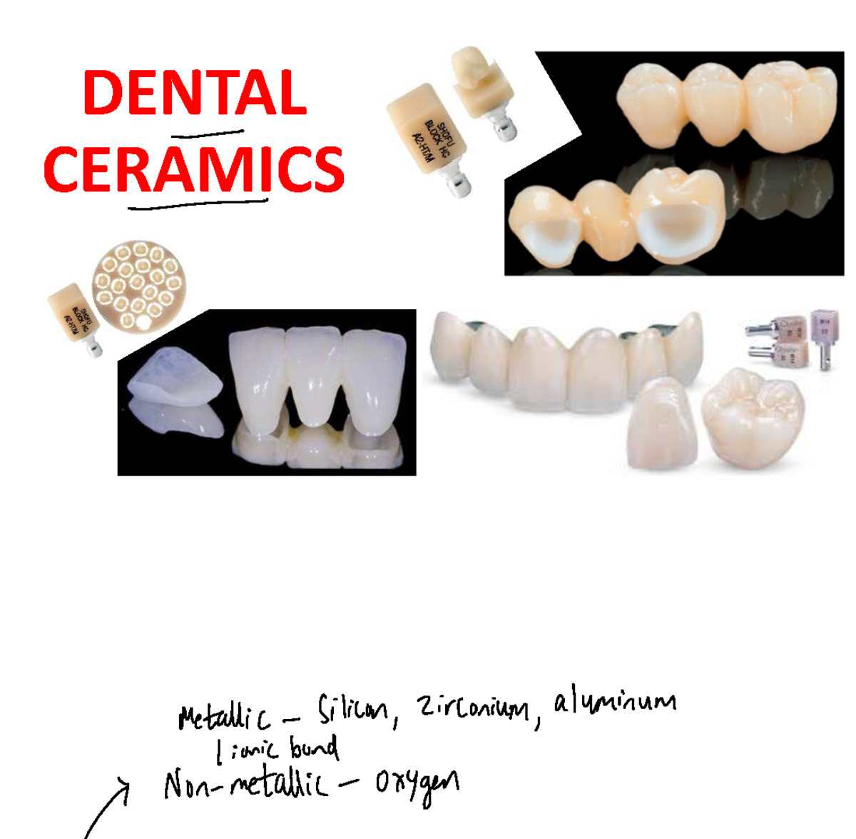 DENT 101: Overview of Dental Ceramics and Their Properties - Studocu