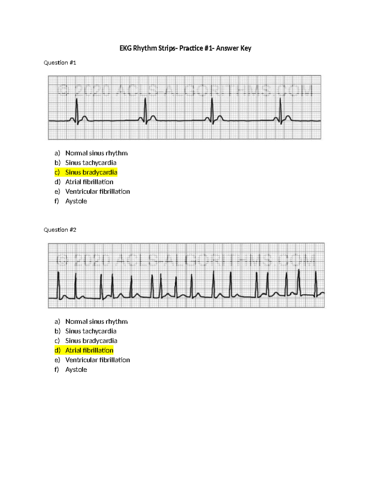 EKG Rhythm Strips Practice #1 - Answer Key and Explanations - Studocu