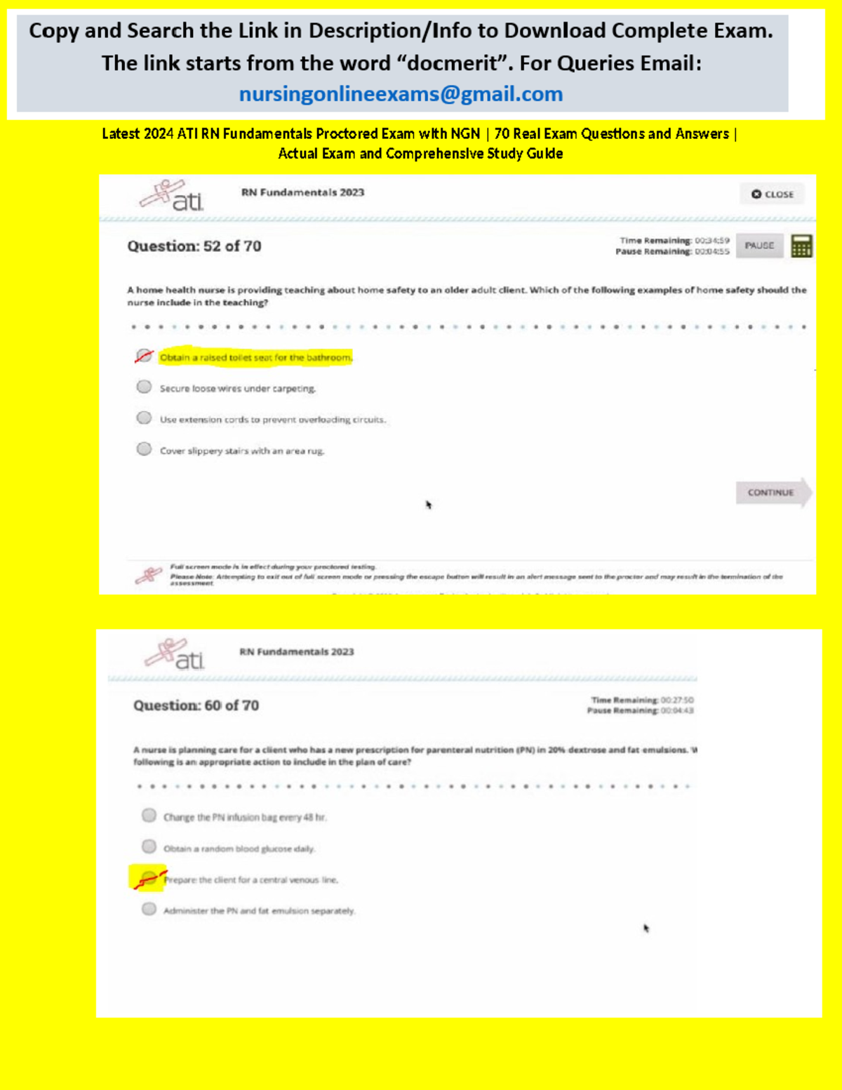 Latest 2024 ATI RN Fundamentals Proctored Exam with NGN 70 Real Exam ...