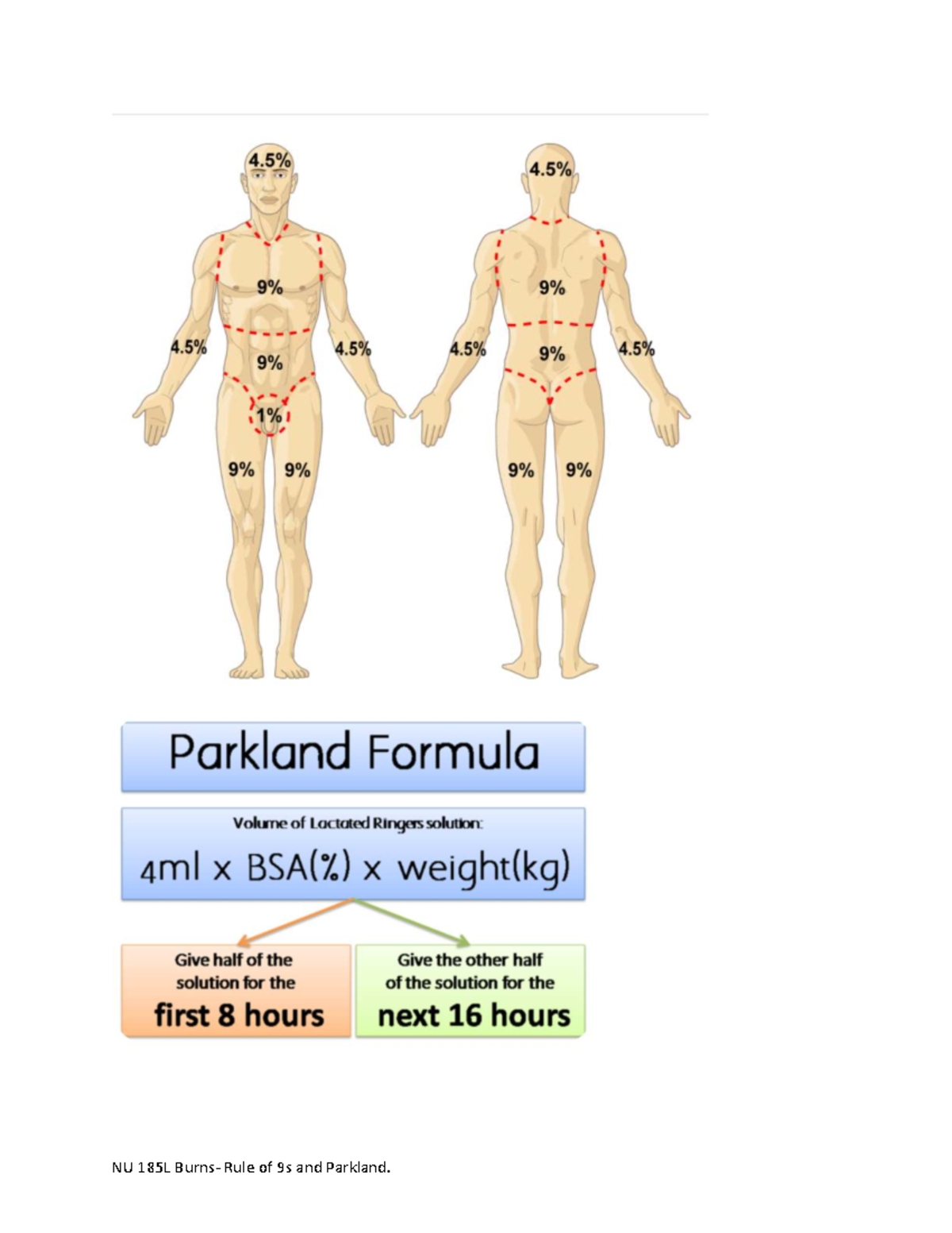 Rule of 9s and Parkland - Burns and rule of 9’s - NU 185 - Parkland ...