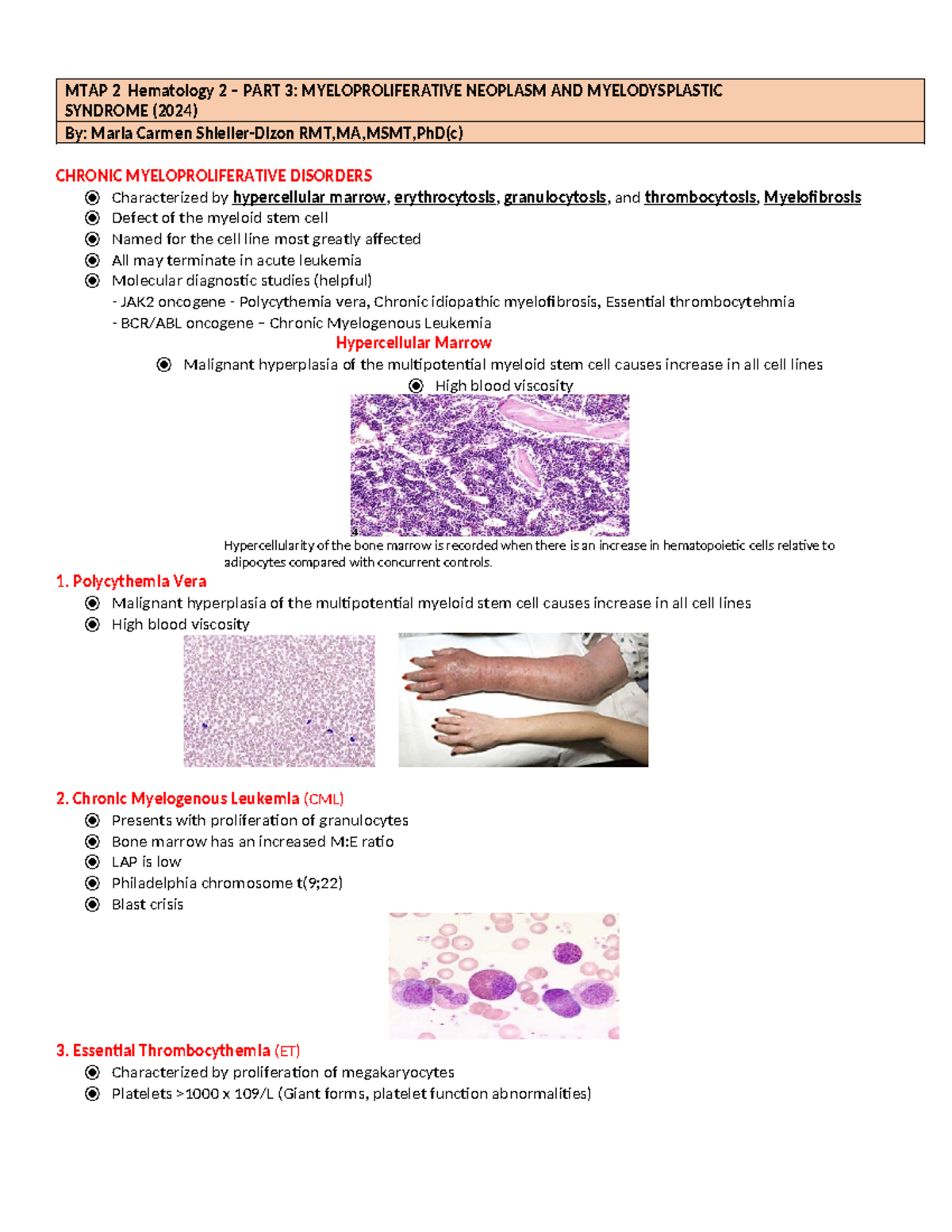 Part 3 Students Hematology 2 - Myeloproliferative Neoplasm AND ...