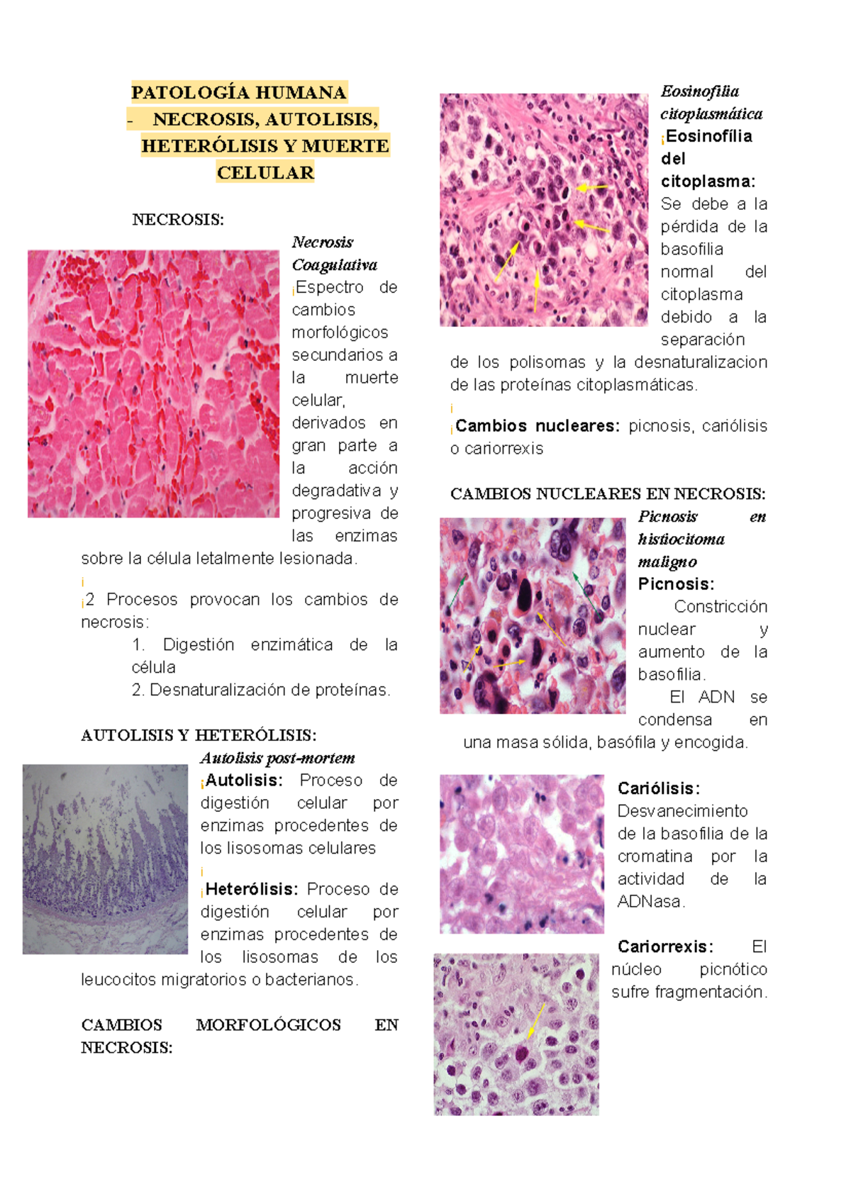 Estudio sobre Necrosis, Autolisis y Heterolisis Celular en PATOLOGÍA ...