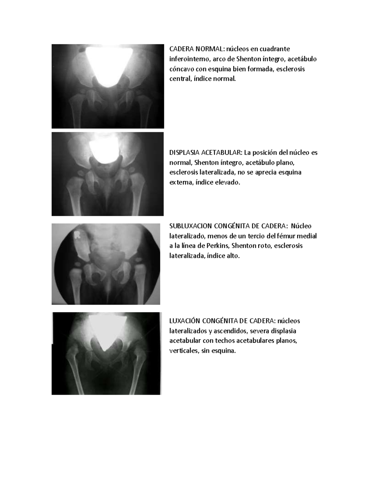 Displasia y Osteocondrosis: Análisis de Cadera y Rodilla - Studocu