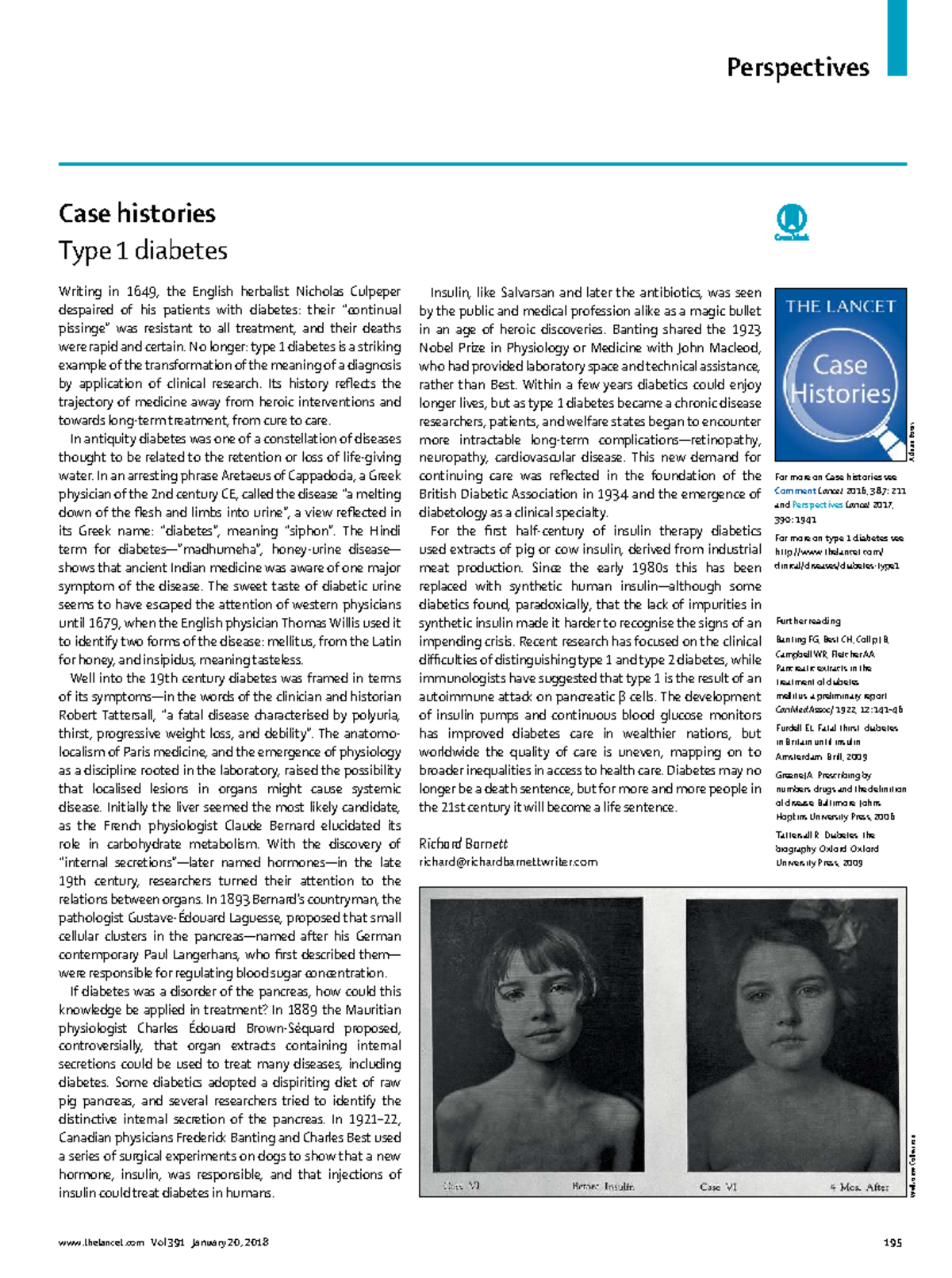 Type 1 Diabetes Advances: Historical Perspectives and Insights - Studocu