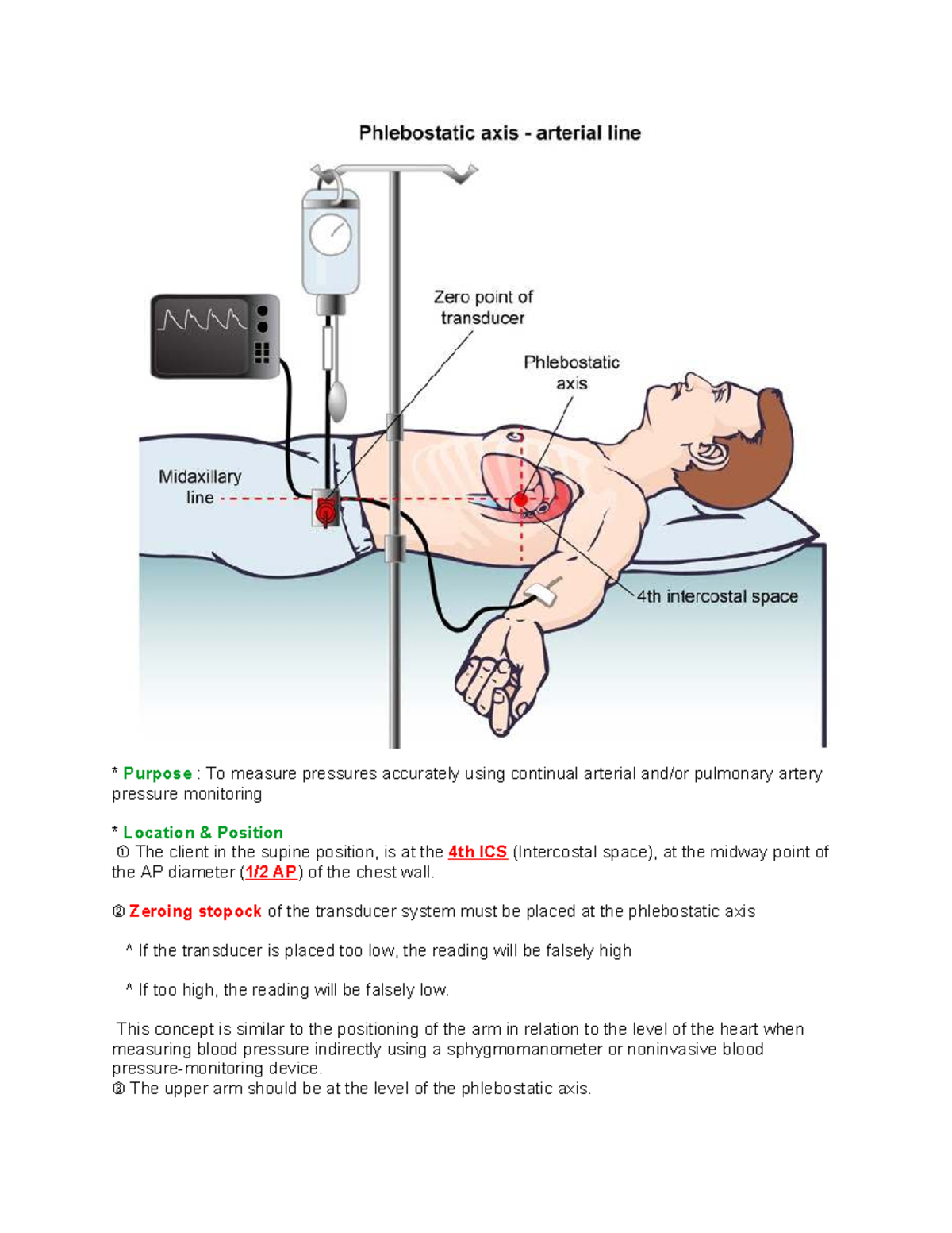 Zeroing Lines for Accurate Arterial Pressure Monitoring - Studocu