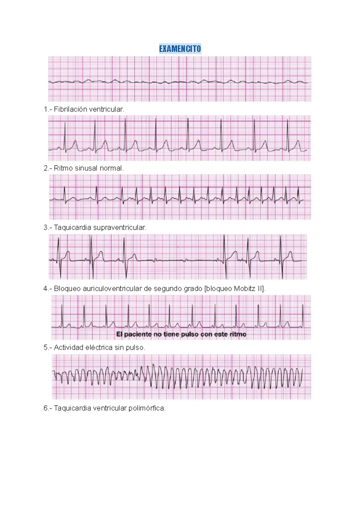 ACLS - Examen Oficial de la Asociación Americana del Corazón - Studocu