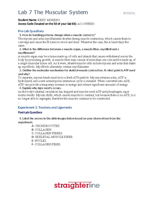 [Solved] Explain the physiological concepts associated with skeletal ...