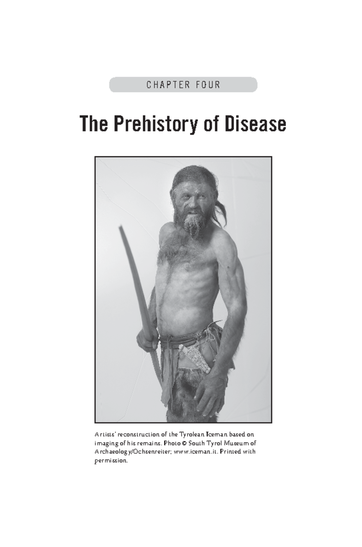 CH4: The Prehistory of Disease - Insights from the Tyrolean Iceman ...