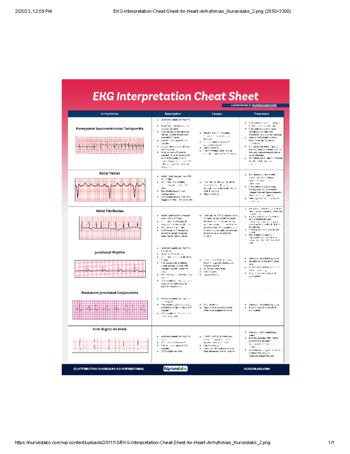 EKG-Interpretation-Cheat-Sheet-for-Heart-Arrhythmias Nurseslabs 2 - 12:09 PM EKG Interpretation - Studocu for Free Printable Ekg Interpretation Cheat Sheet