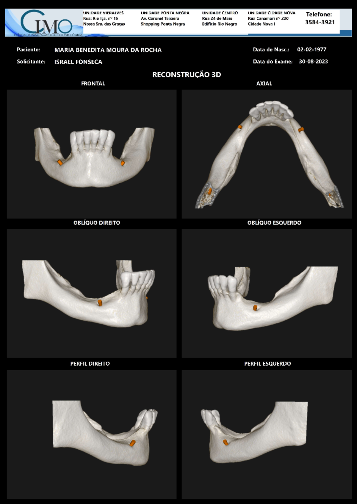 3D Reconstruction Exam Details for Maria Benedita Moura DA Rocha - Studocu