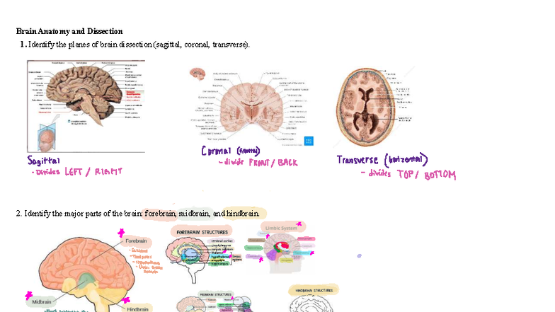Practical 3: Brain Anatomy & Dissection Techniques - Studocu
