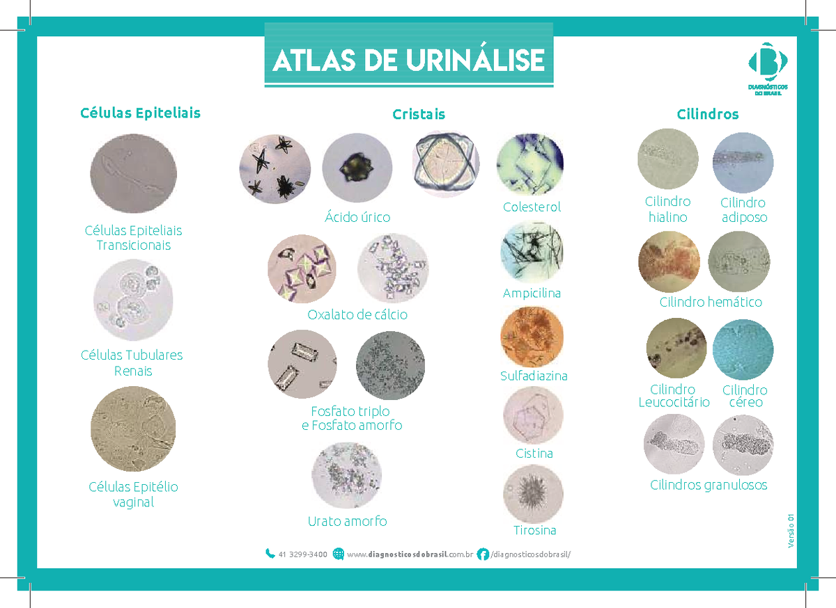 Atlas-de-urianalise - atlas - ATLAS DE URINÁLISE Células Epiteliais ...