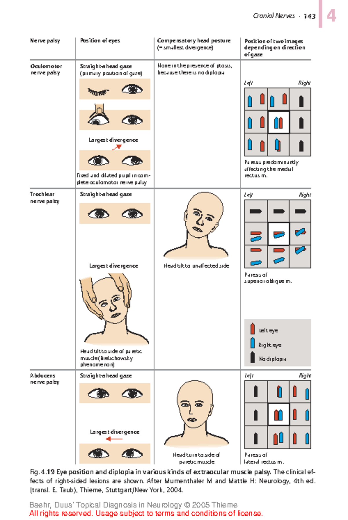 Duus Topical Diagnosis in Neurology-1-200-53 - 1434 Nerve palsy ...