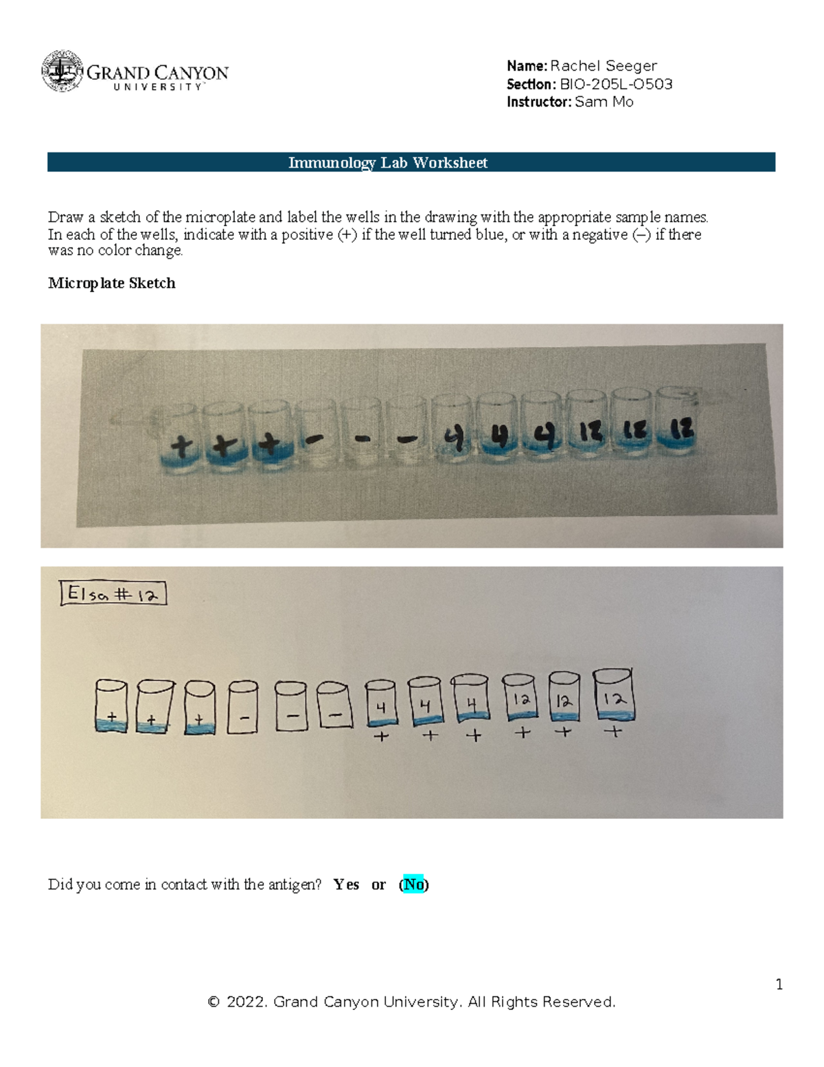 Immunology Lab Worksheet BIO205LO Review & Sketch Instructions Studocu