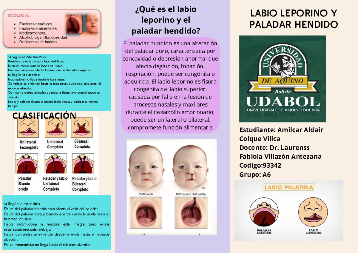 Labio Y Paladar Hendido Bilateral Fentes Palatines | Resultados