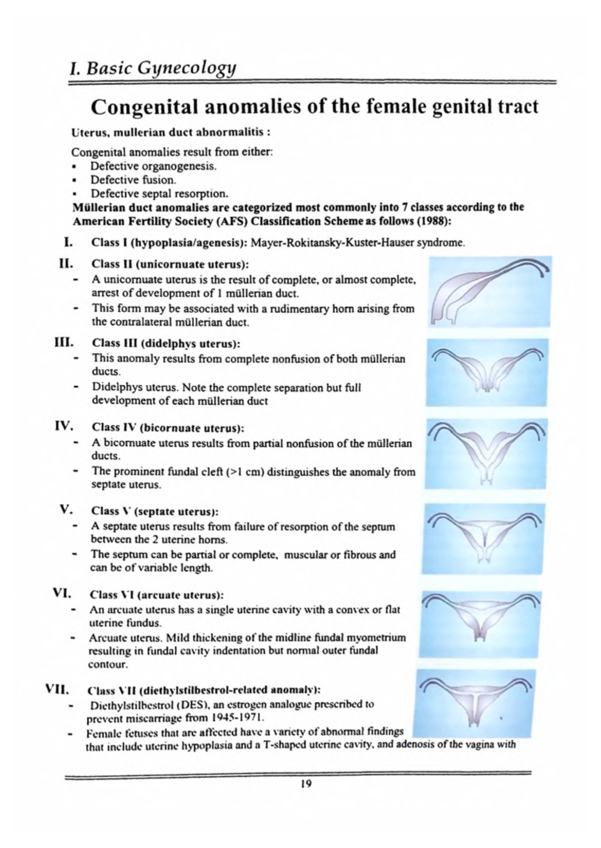 congenital-anomalies-of-the-female-genital-tract-in-gynecology-studocu