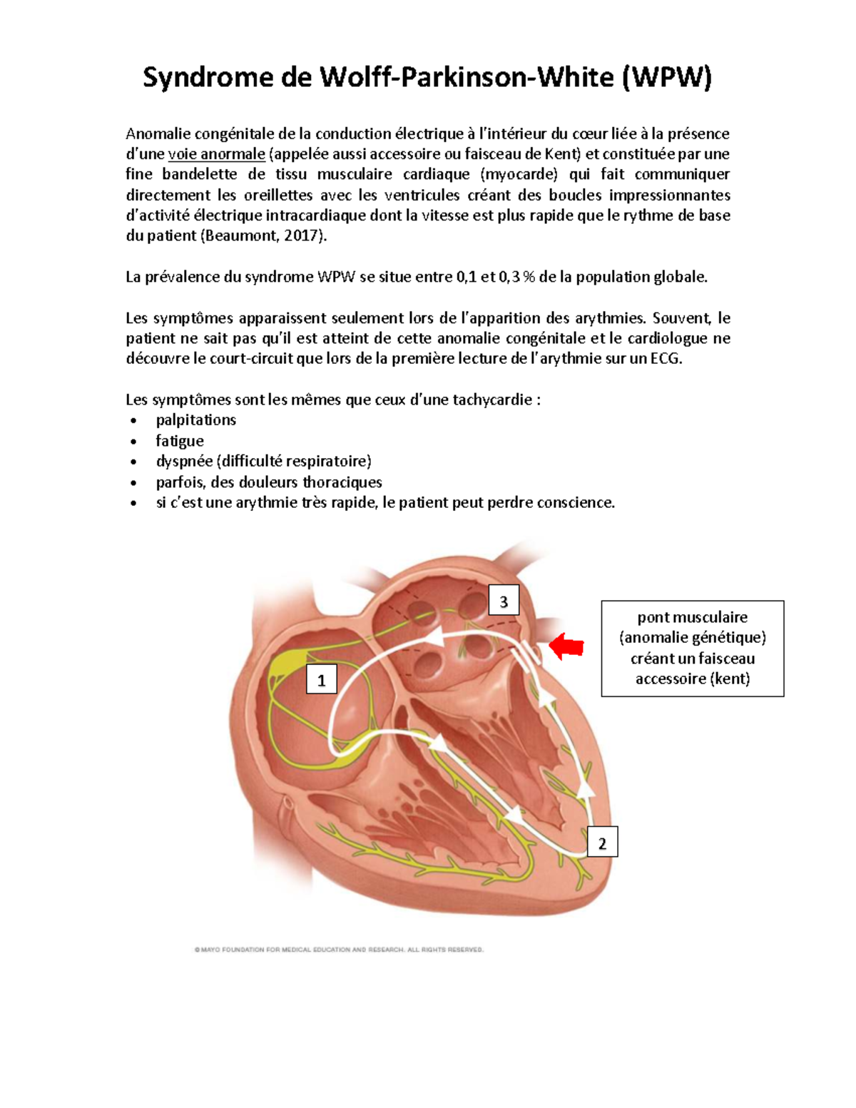 Syndrome de Wolff-Parkinson-White (WPW) : Anomalies de Conduction ...