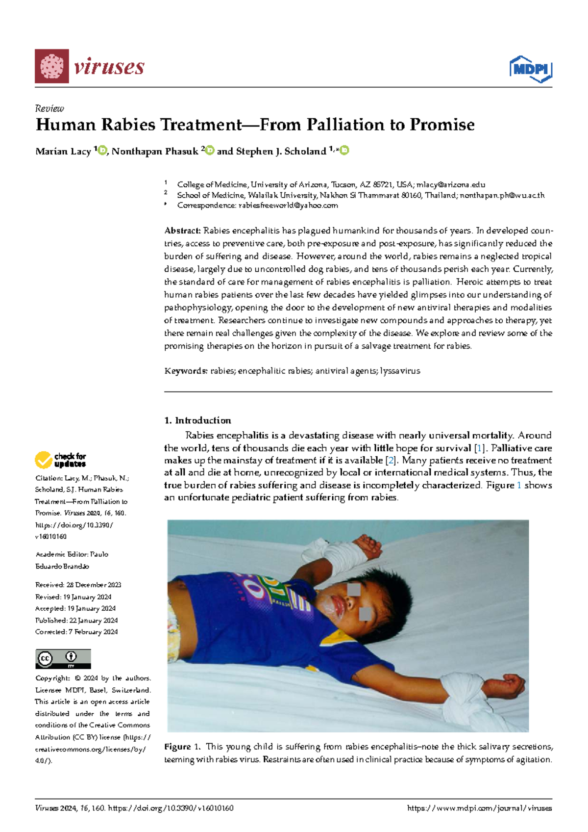 Human Rabies Encephalitis: Challenges and Palliative Care Approaches ...