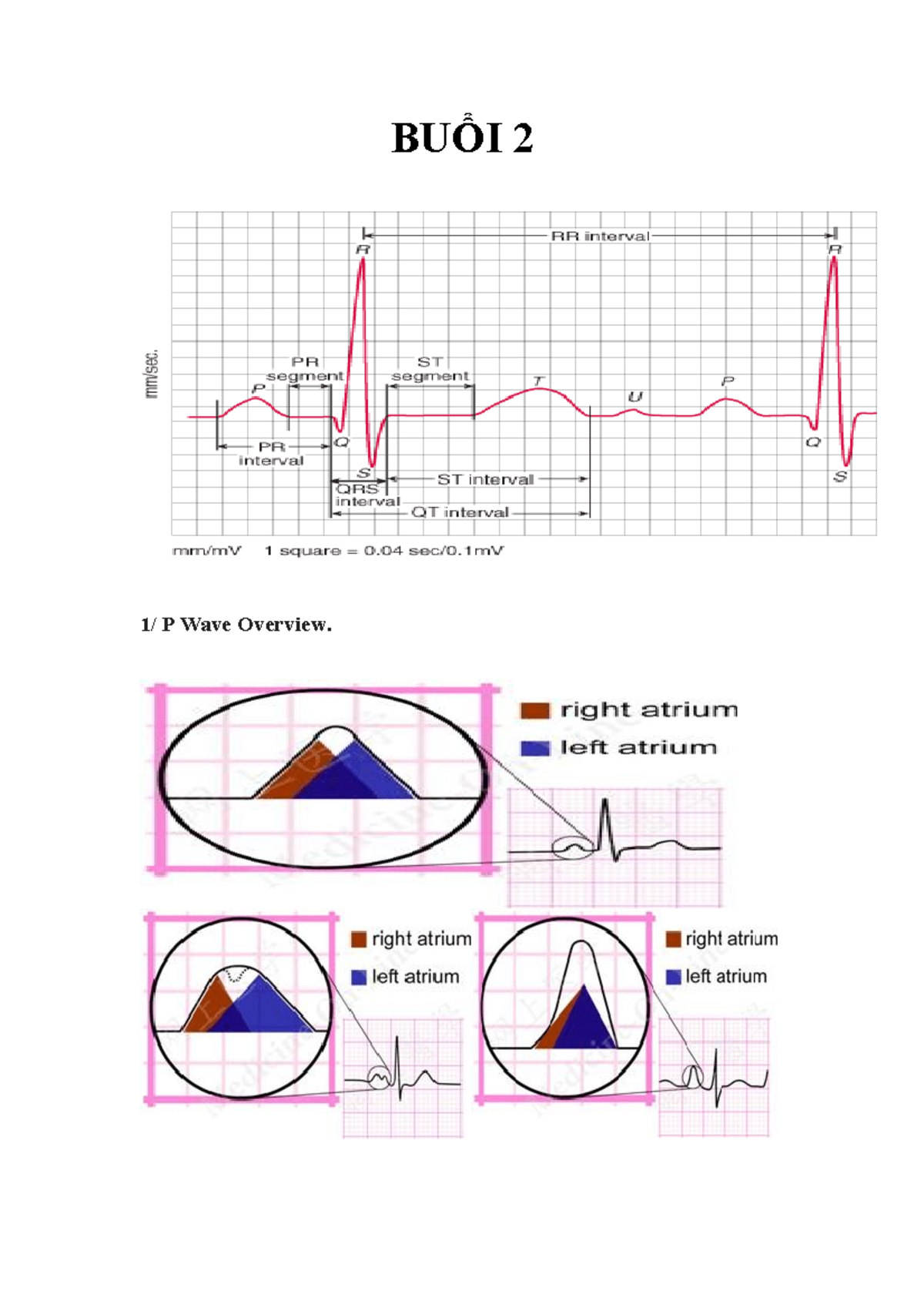 BUỔI 2 - BUỔI 2 - BUỔI 2 1/ P Wave Overview. V V V V Inverted P Waves P ...