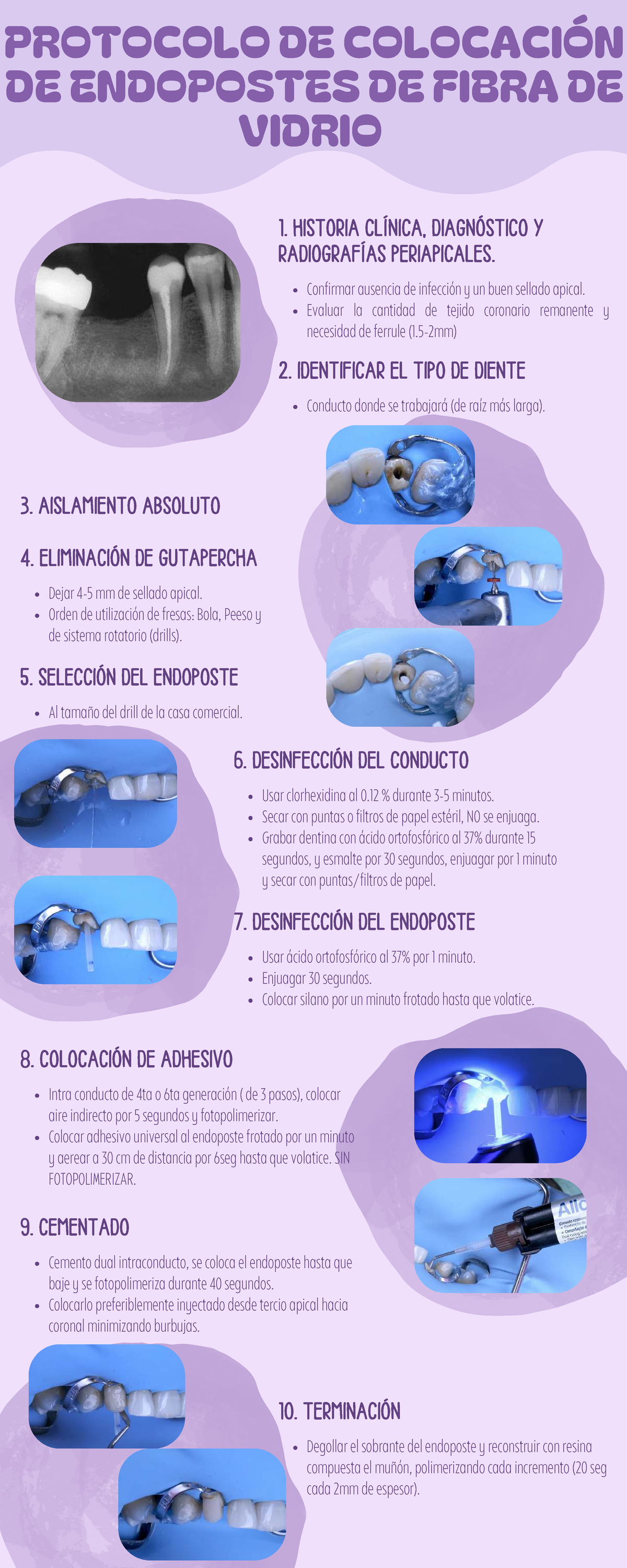 Colocación de Endopostes de Fibra de Vidrio: Protocolo Clínico 20251119 ...