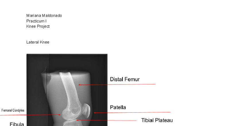 Knee Project Practicum I: Comprehensive Anatomy Analysis - Studocu
