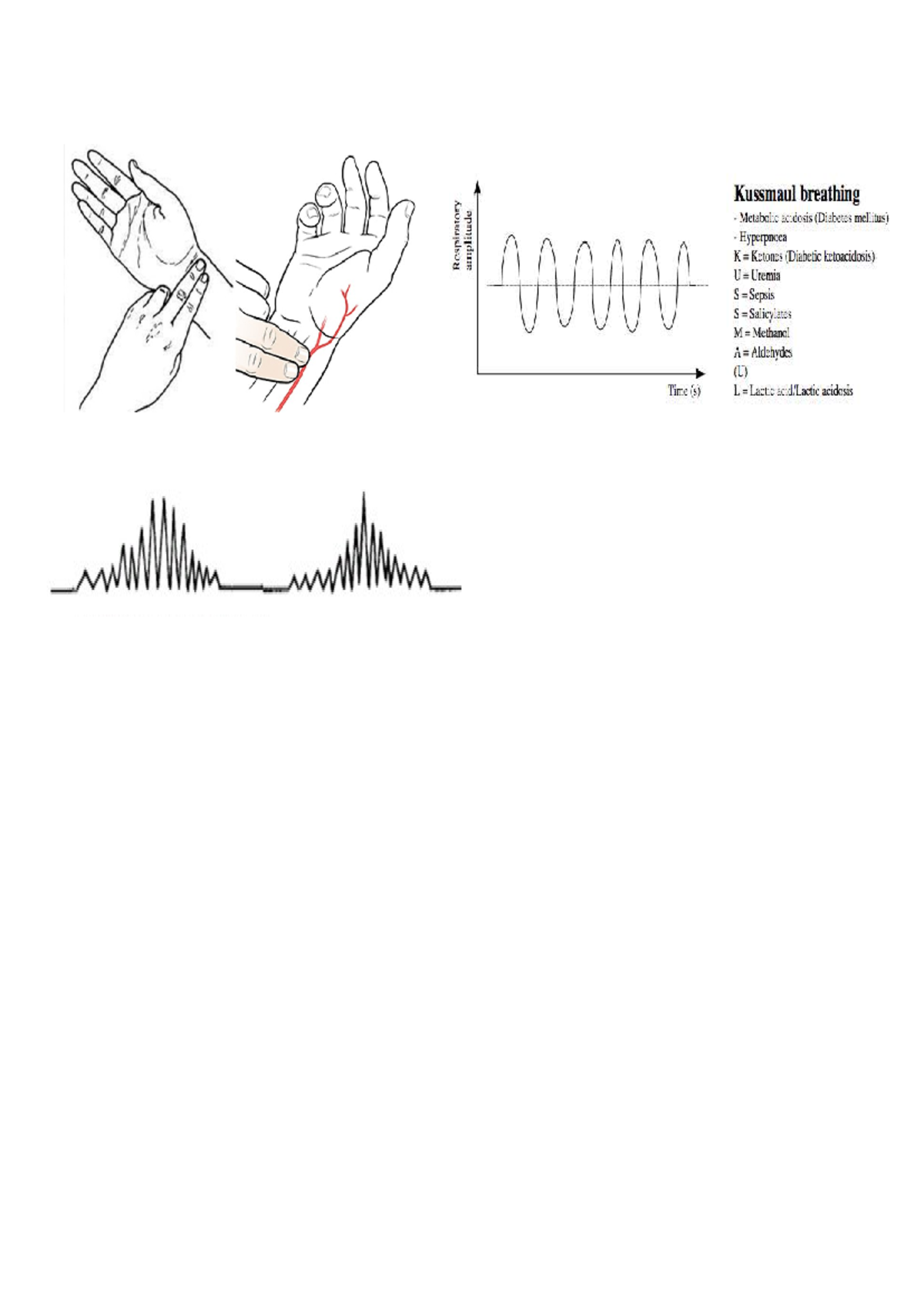 Imprimir - bueno - administración industrial - Kussmaul breathing ...
