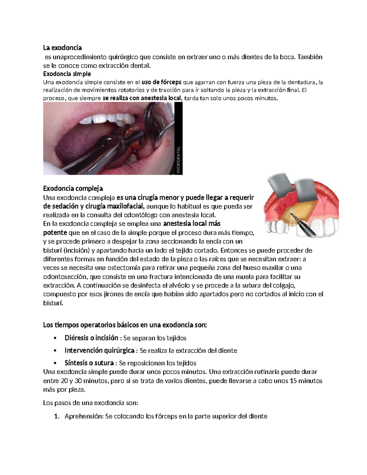 Guía sobre Exodoncia: Procedimientos y Materiales Dentales - Studocu