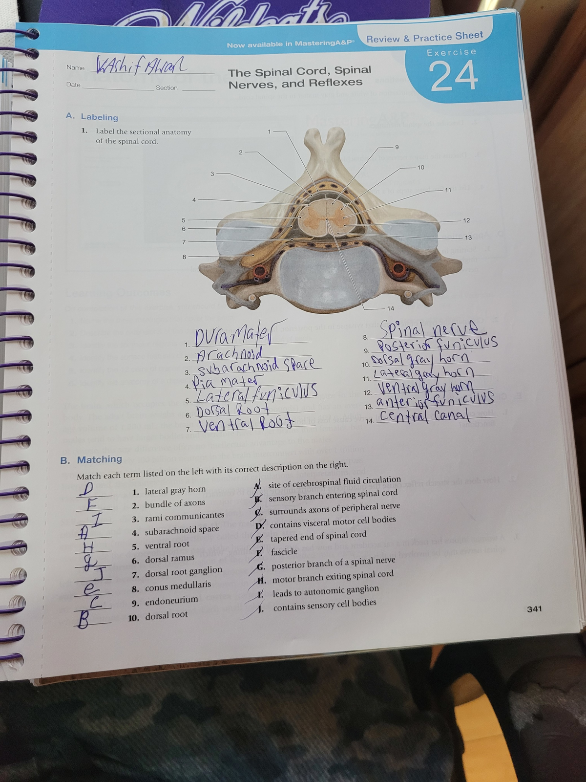 Sectional Anatomy Of Spinal Cord Anatomy Book