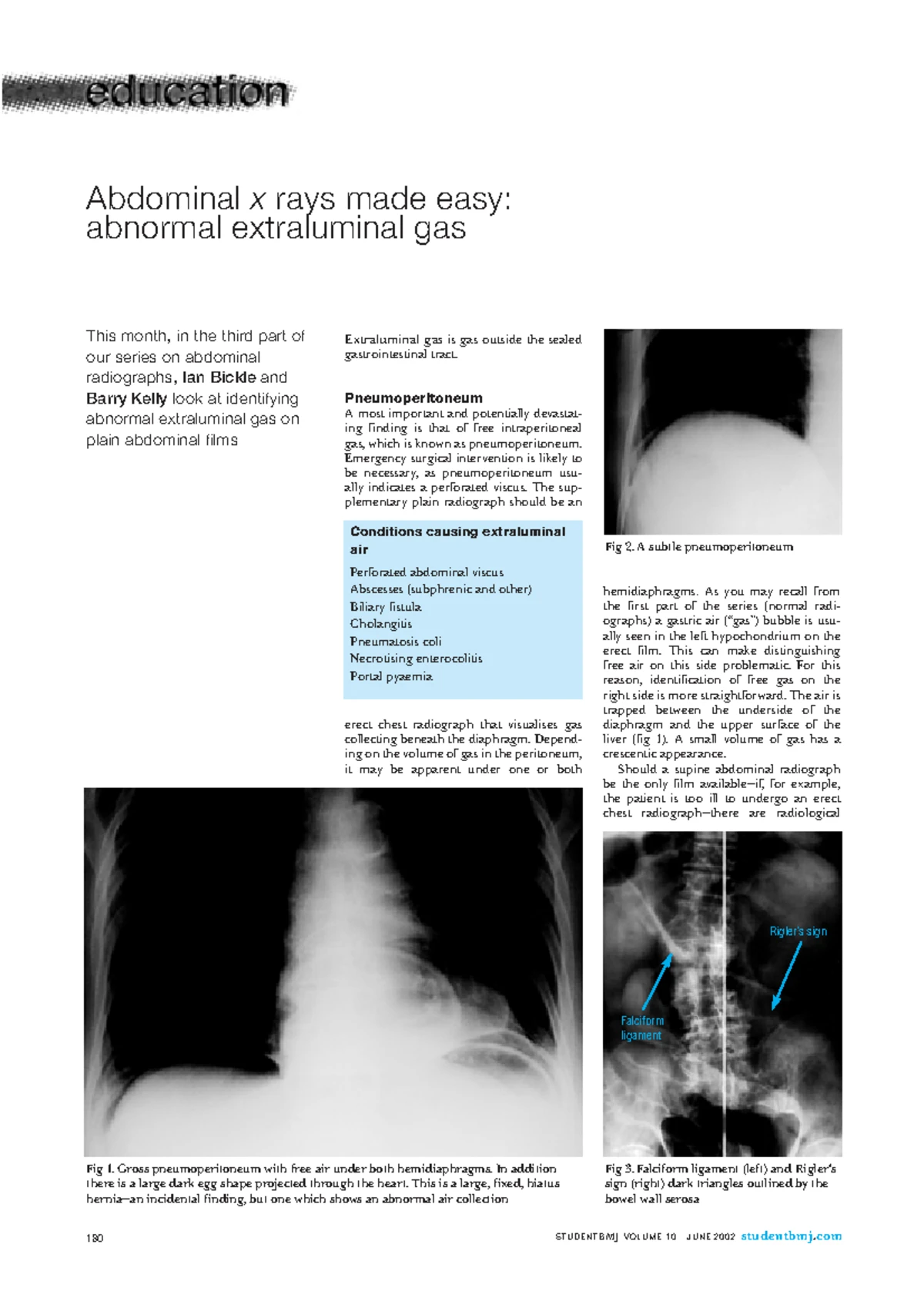 AXR 5: Understanding Iatrogenic, Accidental, and Incidental Objects ...