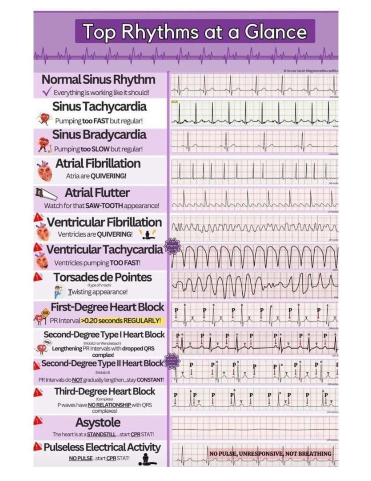 Ritmos Cardiacos ACLS - Auxiliares para Estudio - Studocu