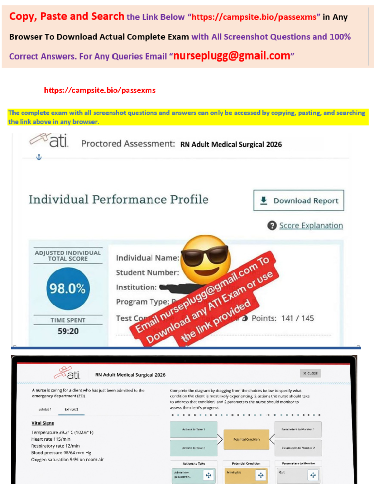Get ATI RN Adult Medical Surgical (Med-Surg) 2026 Proctored Exam NGN ...