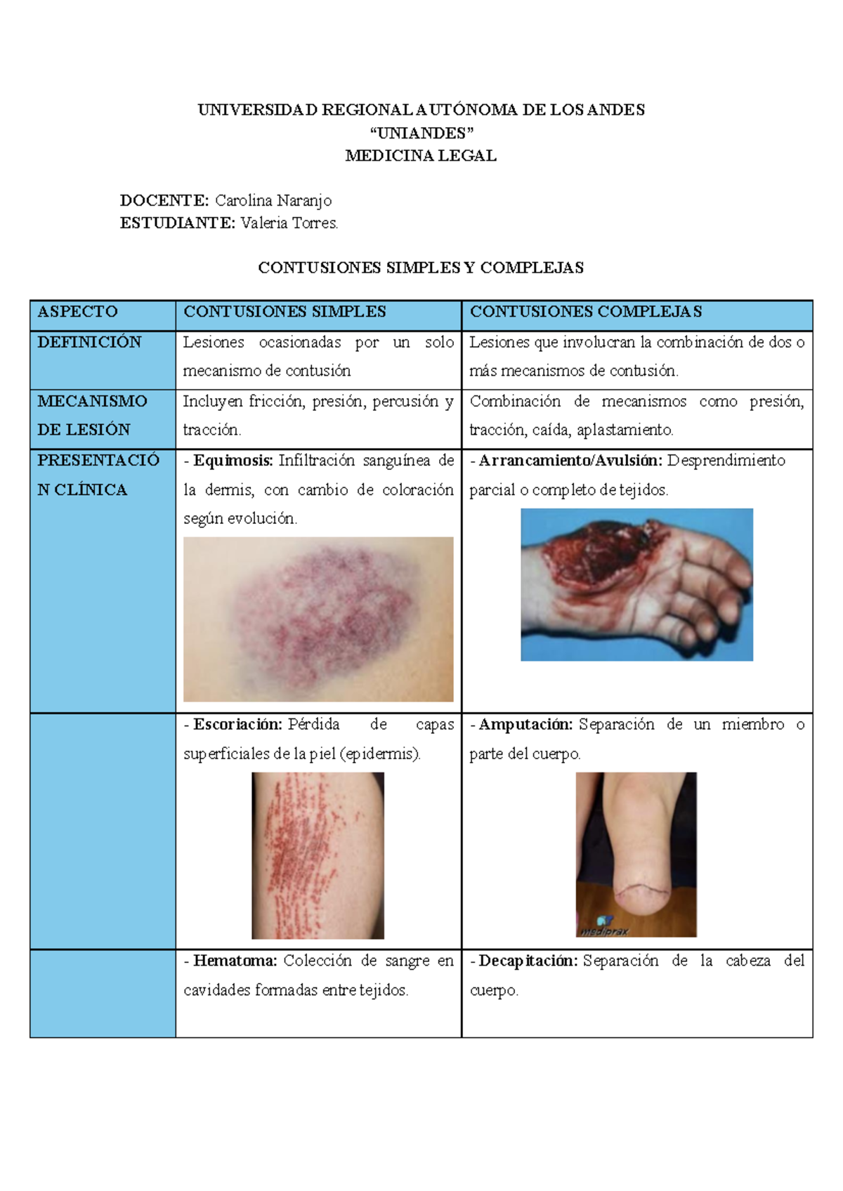 Cuadro Comparativo de Contusiones Simples y Complejas en Medicina Legal ...