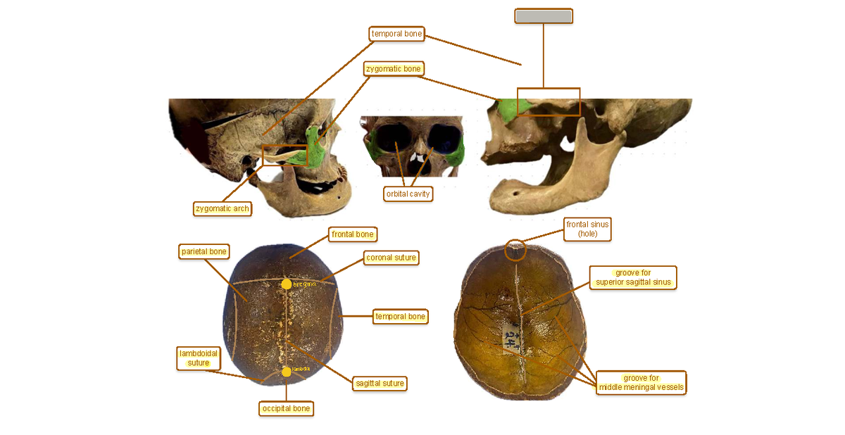 GEN ANA - Zygomatic Arch and Related Bone Structures Exam Notes - Studocu