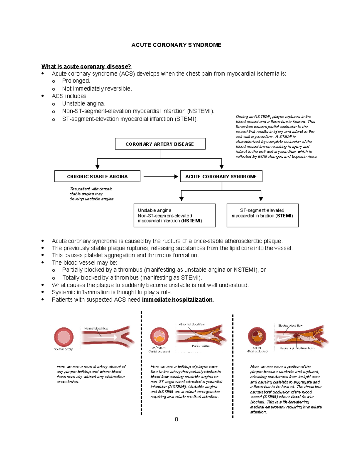 ACUTE CORONARY SYNDROME: Understanding Myocardial Infarction and Angina ...