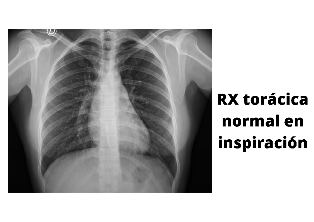 Ejercicios de Interpretación de RX - Curso de Radiología RX-101 - Studocu