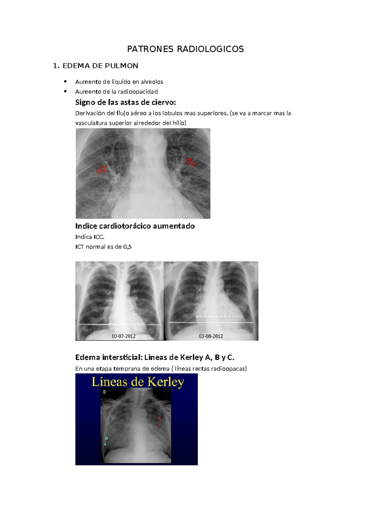 RX Torax - Signos Radiológicos Clave en Patología Pulmonar - Studocu