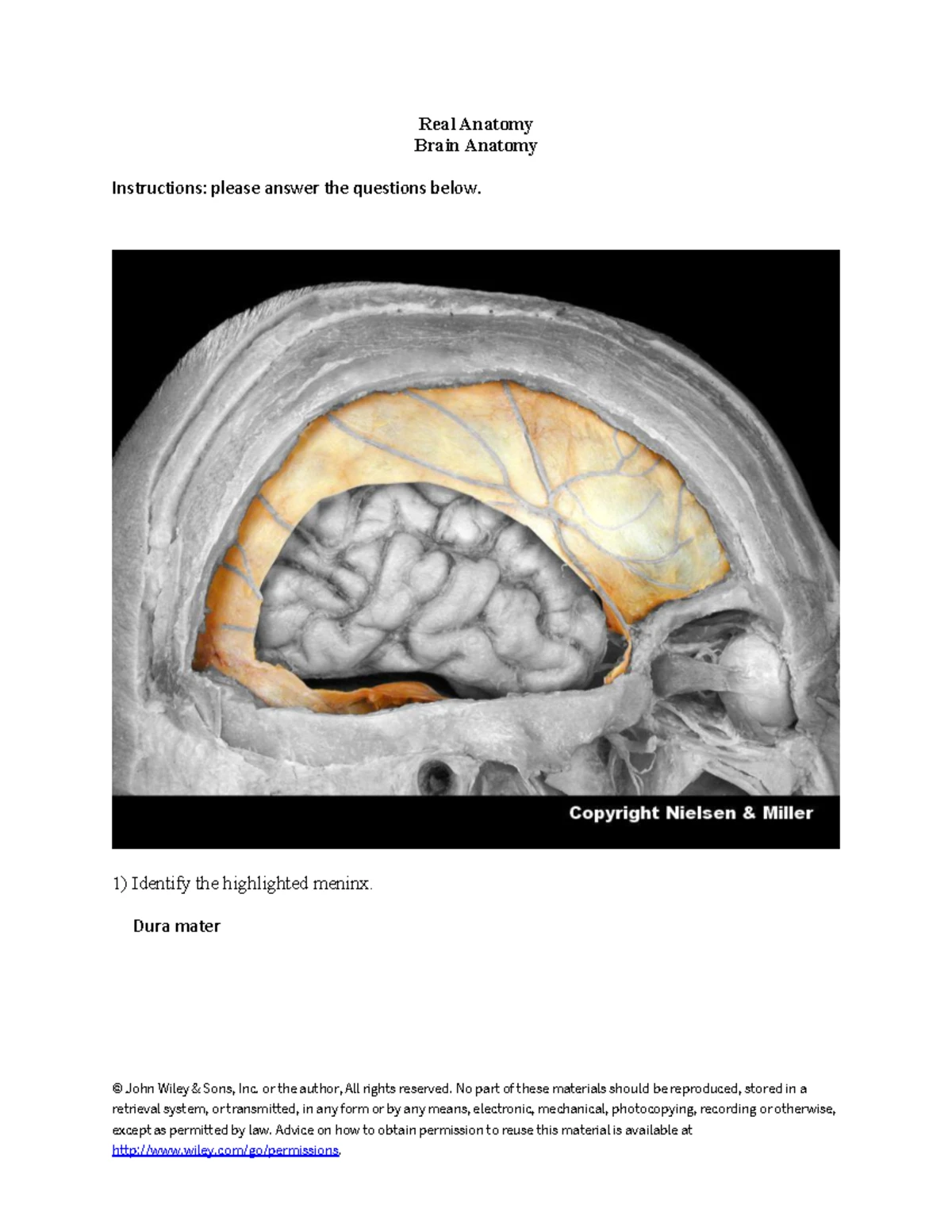 Real Anatomy: 33 Nerves Innervating Major Lower Limb Muscles Worksheet ...